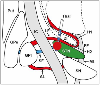 Modeling of Electric Fields in Individual Imaging Atlas for Capsular Threshold Prediction of Deep Brain Stimulation in Parkinson's Disease: A Pilot Study